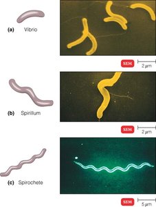 Spiral bacteria and SEM images