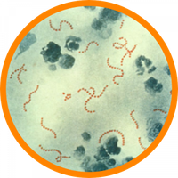 Microscopic image of Streptococcus bacteria