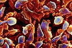 Mycoplasma colonies