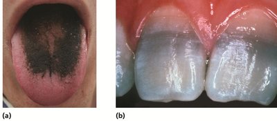 Side effects of antimicrobial agents