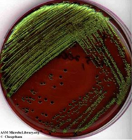 EMB agar plate showing green metallic sheen