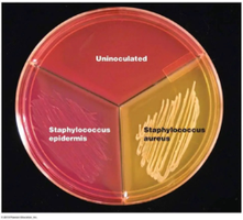 MSA plate with Staphylococcus aureus and Staphylococcus epidermidis