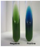 Citrate utilization test: positive (blue) and negative (green)