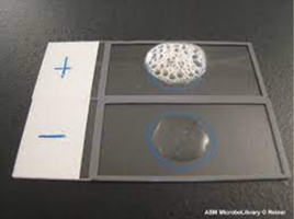 Catalase test: positive (bubbles) and negative (no bubbles)