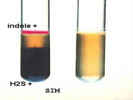 SIM test: indole positive (red ring), H2S positive (black), and negative