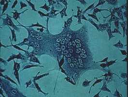 Syncytia formation in measles infection