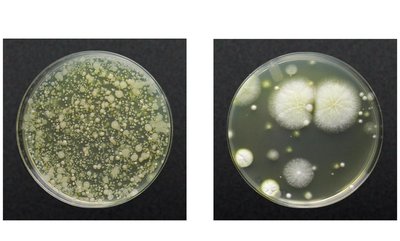 Bacterial and fungal colonies on different agars