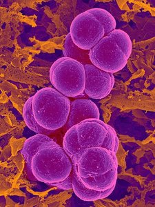 Cocci-shaped bacteria under microscope