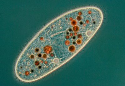 Microscopic image of a protozoan