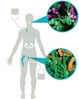 Biofilm formation on medical devices and tissues