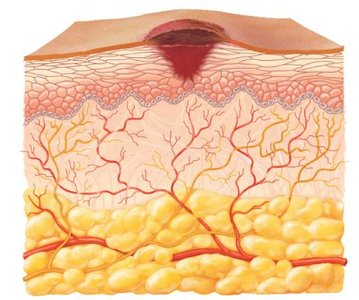 Tissue repair after inflammation