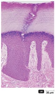 Section through human skin showing epidermis and dermis