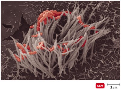 Ciliated cells of the respiratory system infected with Bordetella pertussis