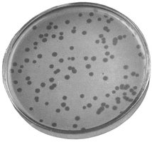 Petri dish with bacteriophage plaques