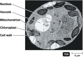 Transmission electron micrograph of plant cell