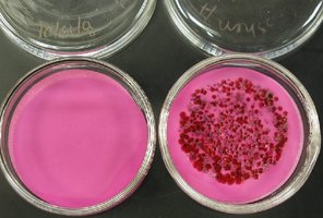 Colony growth on differential media after membrane filtration