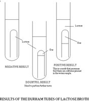 Diagram of Durham tube results in lactose broth