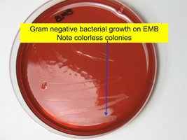 Gram negative bacterial growth on EMB, note colorless colonies