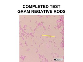 Gram stain of Gram-negative rods from completed test