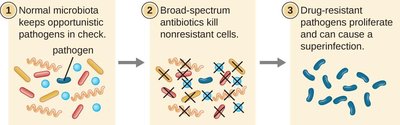 Development of superinfection due to broad-spectrum antibiotics