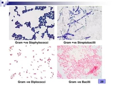 Gram stain results for different bacterial morphologies