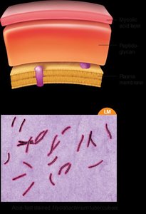 Acid-fast cell wall structure and stained cells