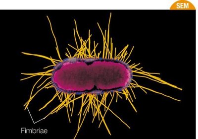 Fimbriae on a bacterial cell
