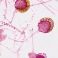 Sporangium and sporangiophore of Rhizopus