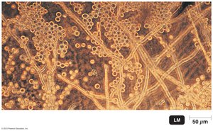 Yeastlike and moldlike growth