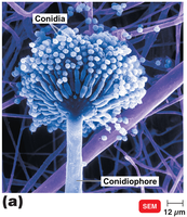 Conidiophore with conidia (Aspergillus)