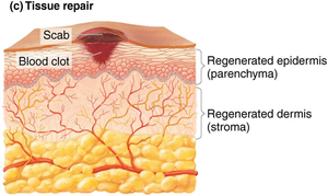 Tissue repair showing regenerated epidermis and dermis