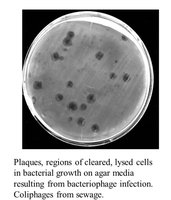 Plaques formed by bacteriophage infection on agar plate
