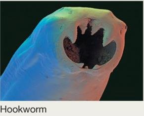 Hookworm micrograph