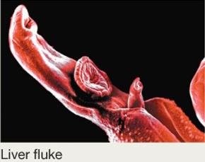 Liver fluke micrograph