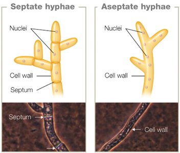 Septate and aseptate hyphae