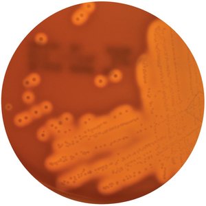 Blood agar as a differential medium
