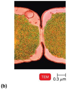 TEM of dividing E. coli cell