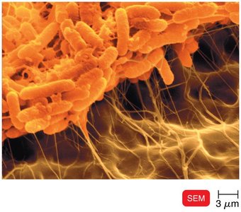 Biofilm on plastic under SEM