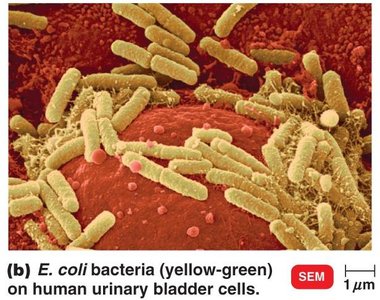 Salmonella entering intestinal epithelial cells