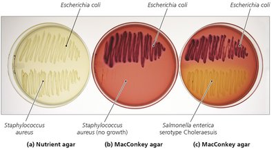 MacConkey agar as selective and differential medium
