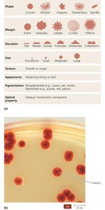 Characteristics of bacterial colonies