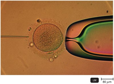 Microinjection of foreign DNA
