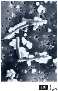 Bacillus cells growing on selenium