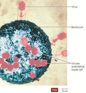 Electron microscope image of viruses infecting a bacterium