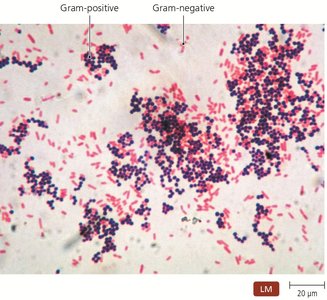 Results of Gram staining showing Gram-positive and Gram-negative bacteria