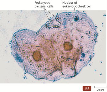 Bacterial cells and human cheek cells under a microscope