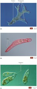 Protozoa with pseudopods, cilia, and flagella
