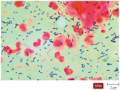 SEM of Streptococcus pneumoniae