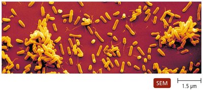 SEM of Haemophilus influenzae