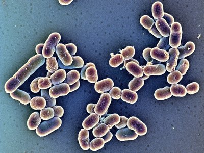 SEM of Streptococcus agalactiae